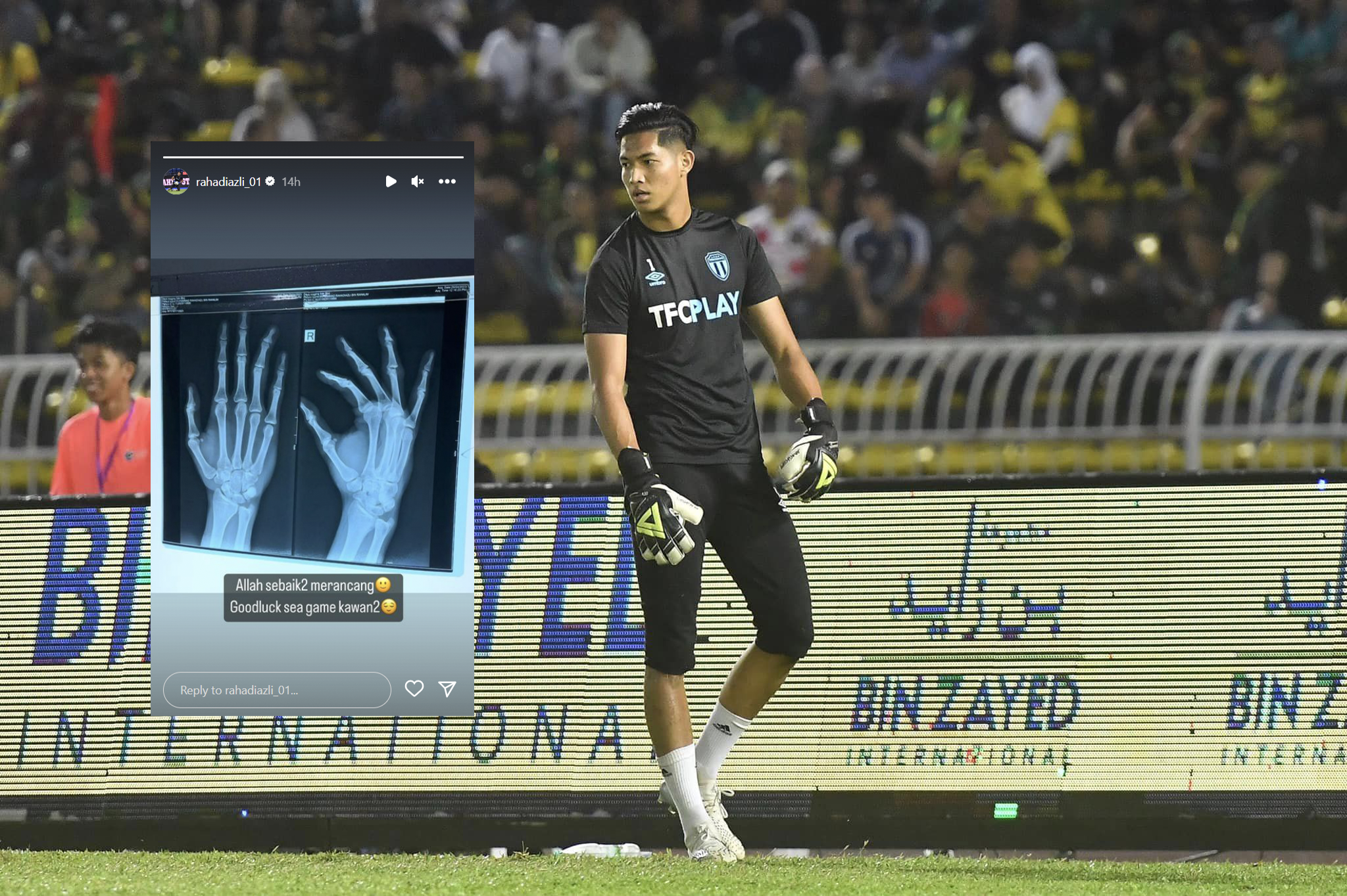 Rahadiazli Kongsi Gambar ‘X-Ray’ Selepas Tersisih Daripada Skuad B-22 Negara Ke Kemboja